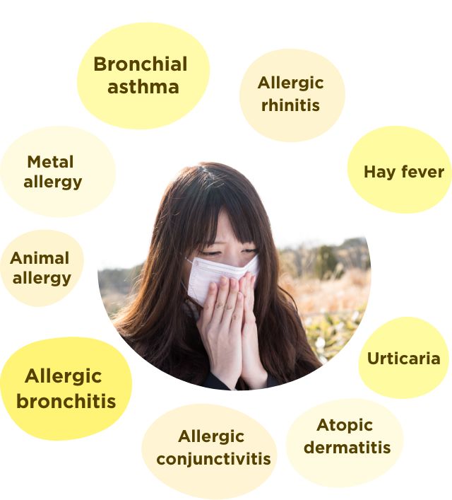 Hay fever, Bronchial Asthma, Allergic rhinitis, Allergic bronchitis, Allergic conjunctivitis, Atopic dermatitis, Metal Allergy, Animal allergy, Urticaria...
